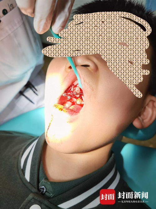 重慶特斯拉車主遭遇驚魂一幕 停車時車輛自動加速撞墻，致孩子受傷